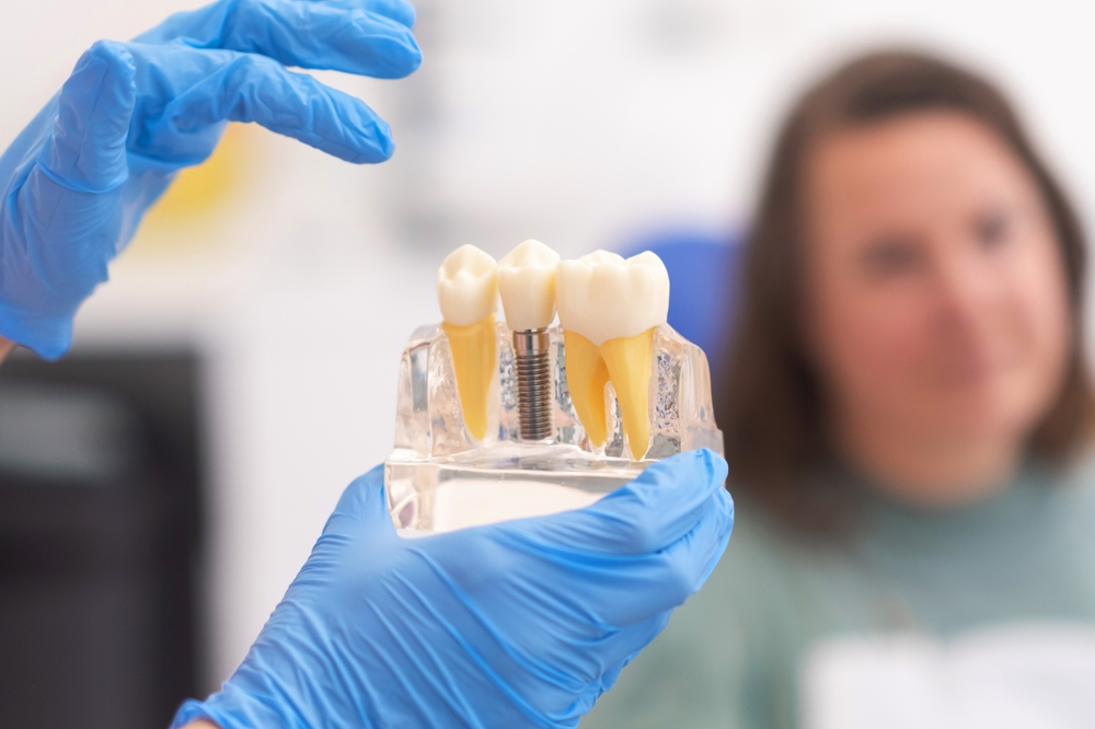 a dental implant is a painful process dispelling the myth